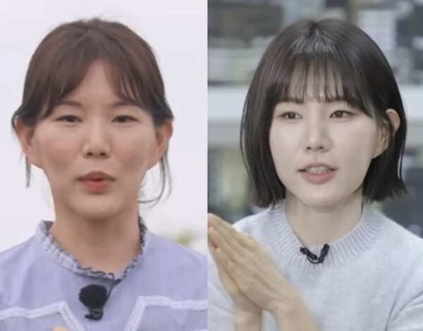 ‘나는솔로’ 현숙이 받고 ‘여신’ 됐다는 필러·보톡스... 정말 괜찮을까?