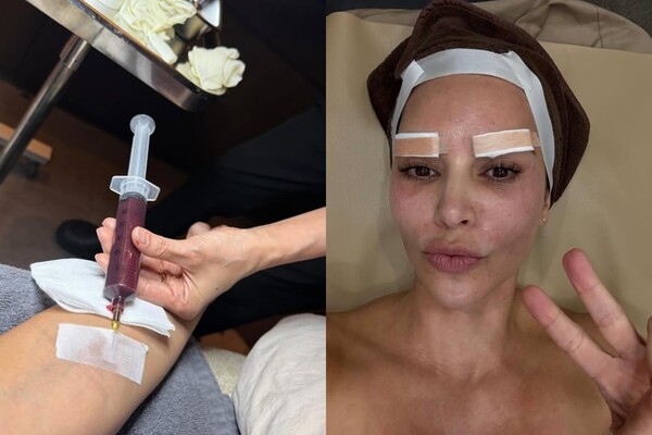 Are the Kardashian sisters coming to Korea for “this”? The Korean dermatology treatments drawing global attention
