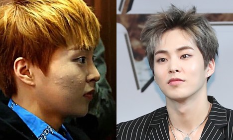 “Their skin looks like this offstage?” Emergency skin care for active idols